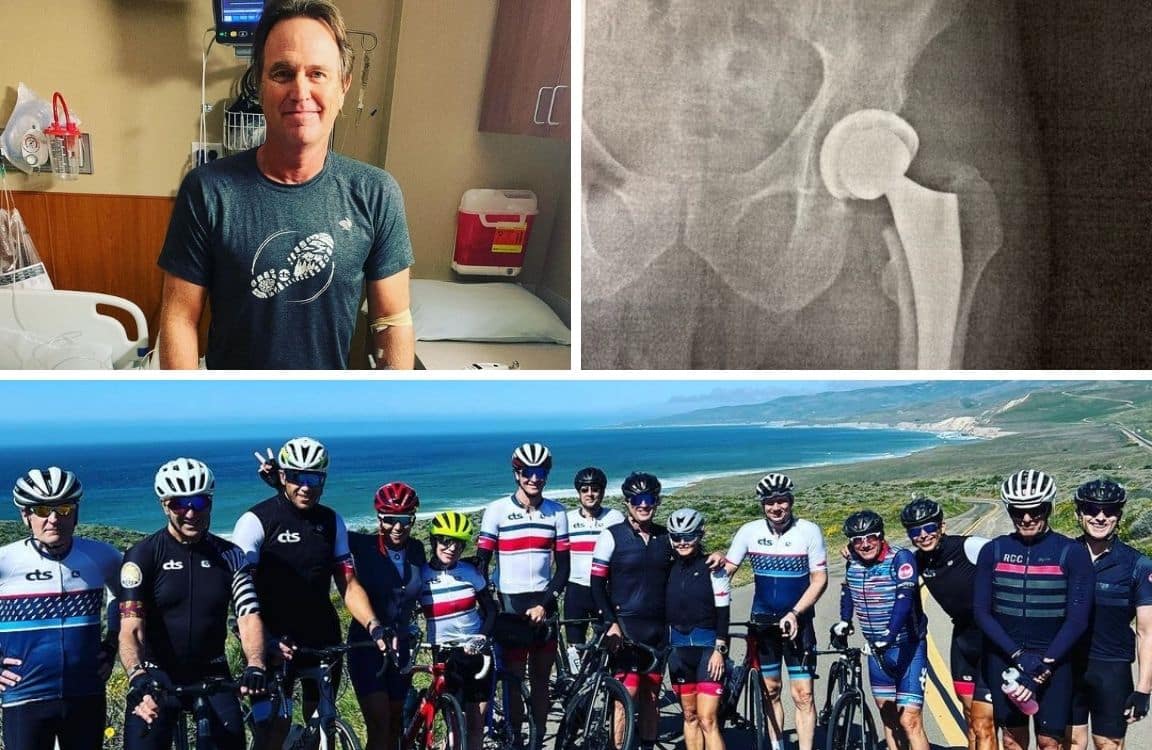 hip replacement
